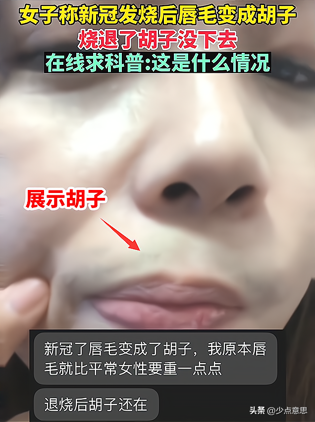 ​江苏：女子阳后长出来胡子，被怀疑是特效，“我这怎么出门啊”